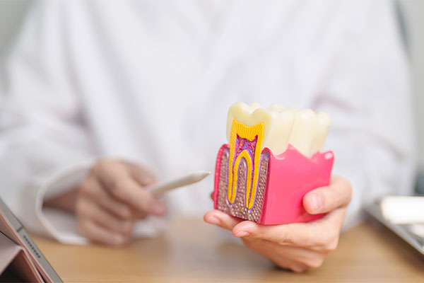 The Steps Of A Dental Crown Restoration
