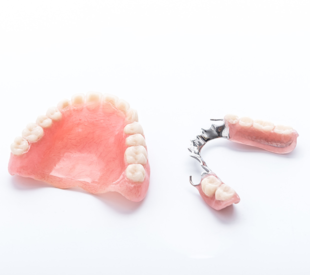 Houston Partial Dentures for Back Teeth